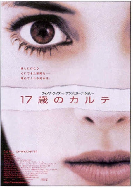 17歳のカルテ
